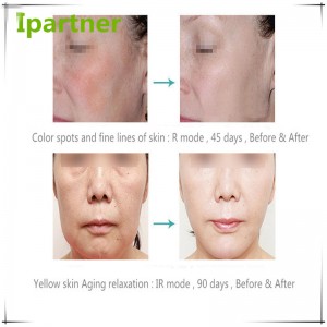 Hot πώλησης LED Φωτοθεραπεία Ομορφιά Εξοπλισμός για την περιποίηση του δέρματος