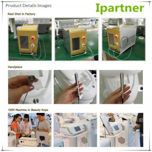 Το Ipartner LS980 Laser Diode ανακουφίζει το σύστημα ερυθρότητας