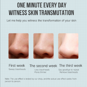 Ηλεκτρικός εξαγωγέας ακμής αφαίρεσης ασφάλισης Blackhead Remover κενού Ομορφιά μηχανή Pore Cleaner