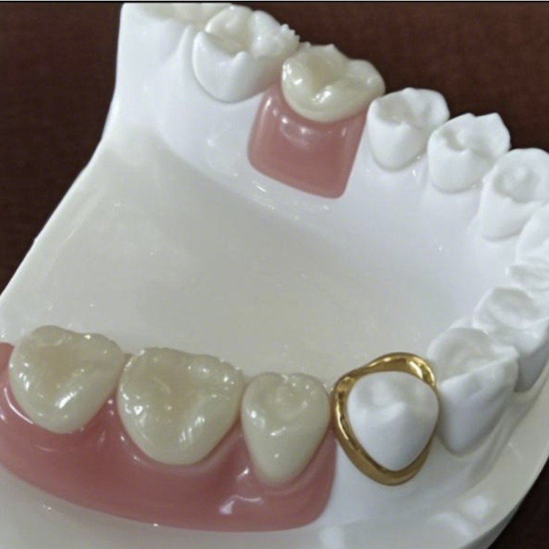 Προσκόλληση ακριβείας