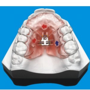 Ορθοδοντική σειρά